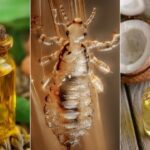 piojos y liendres remedios caseros para eliminarlas definitivamente